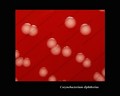 corynebacterium diphtheriae